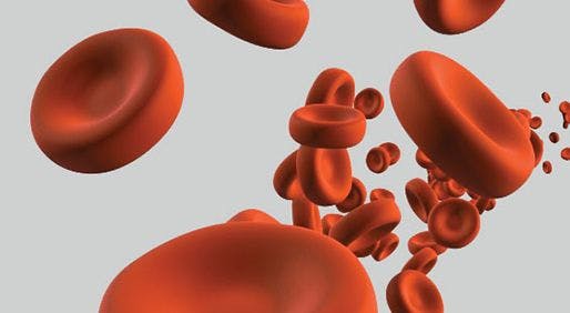 image of blood cancer cells
