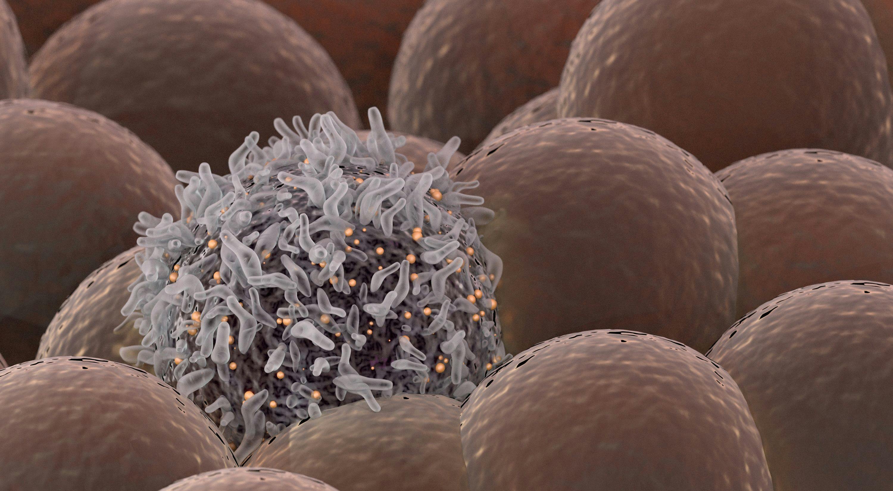 Only Certain Gynecologic Malignancies Benefit from Immunotherapy