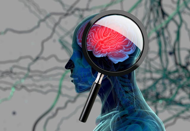 highlighted brain image with a magnifying glass
