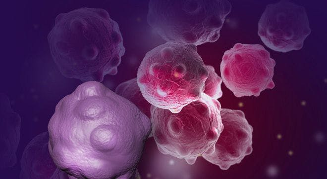 Addition of Ofatumumab to Aggressive Chemotherapy Regimen Yields High Response Rates in Newly Diagnosed Mantle Cell Lymphoma