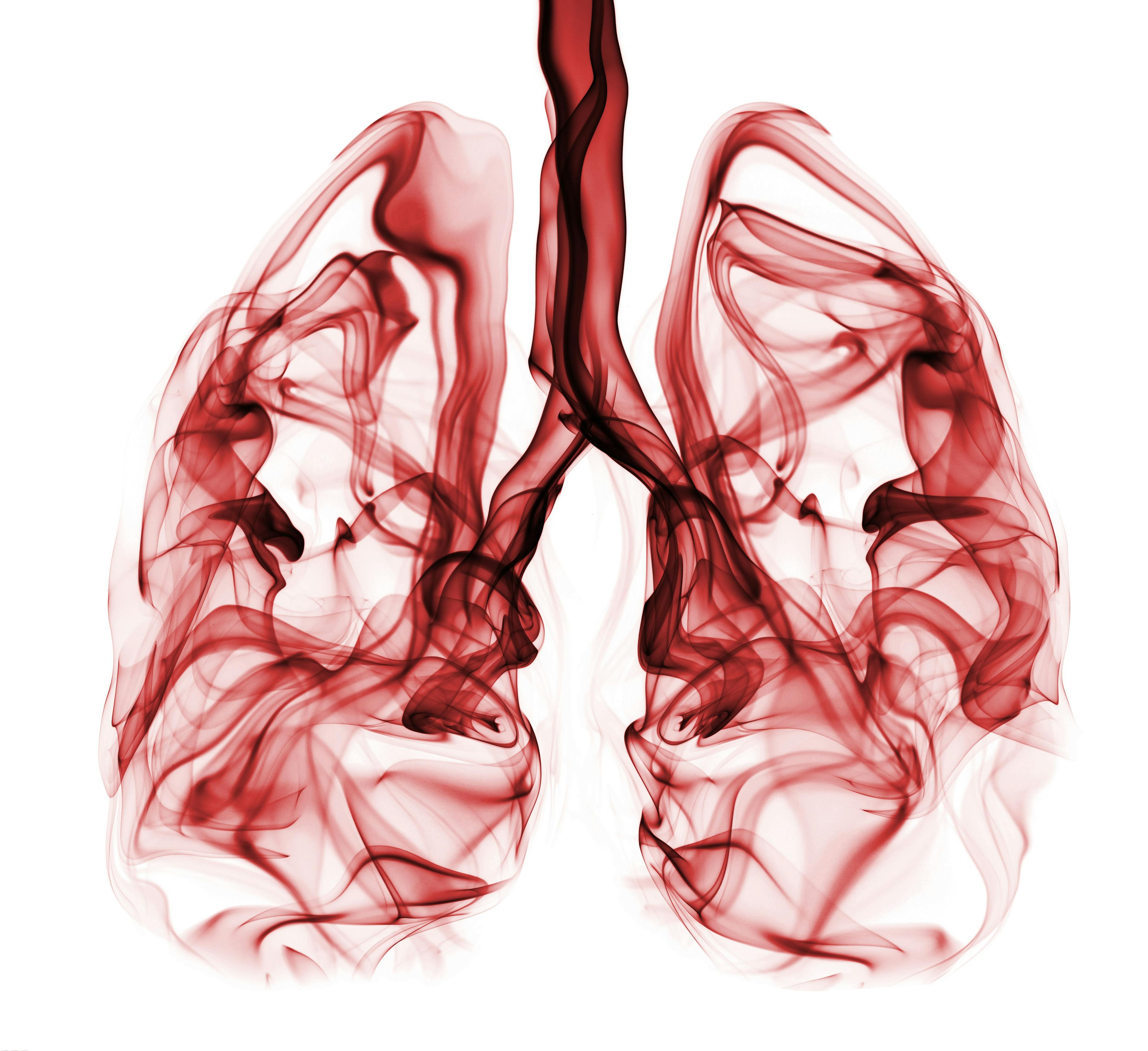 CURE® Educated Patient® Full Lung Webinar