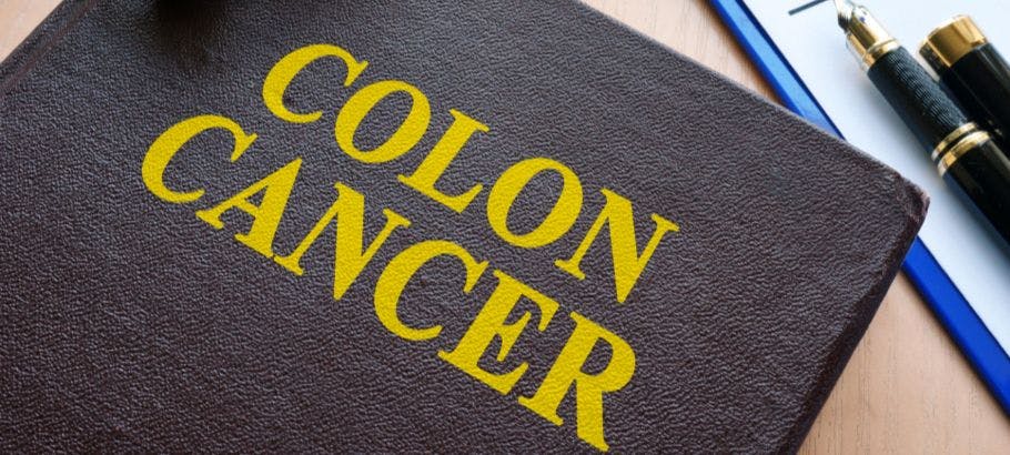Image of a brown book that says "Colon Cancer."