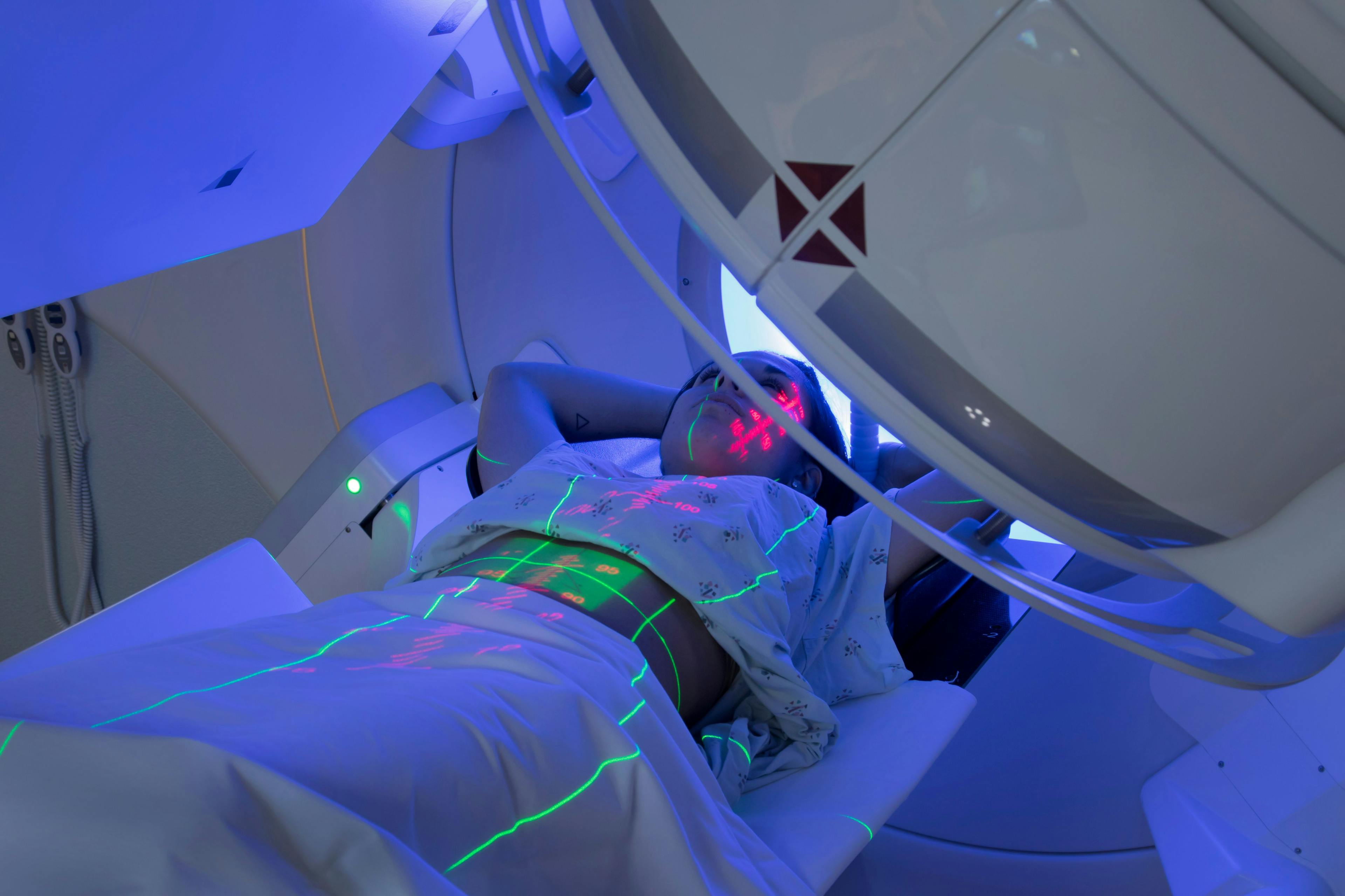 woman undergoing radiation treatment