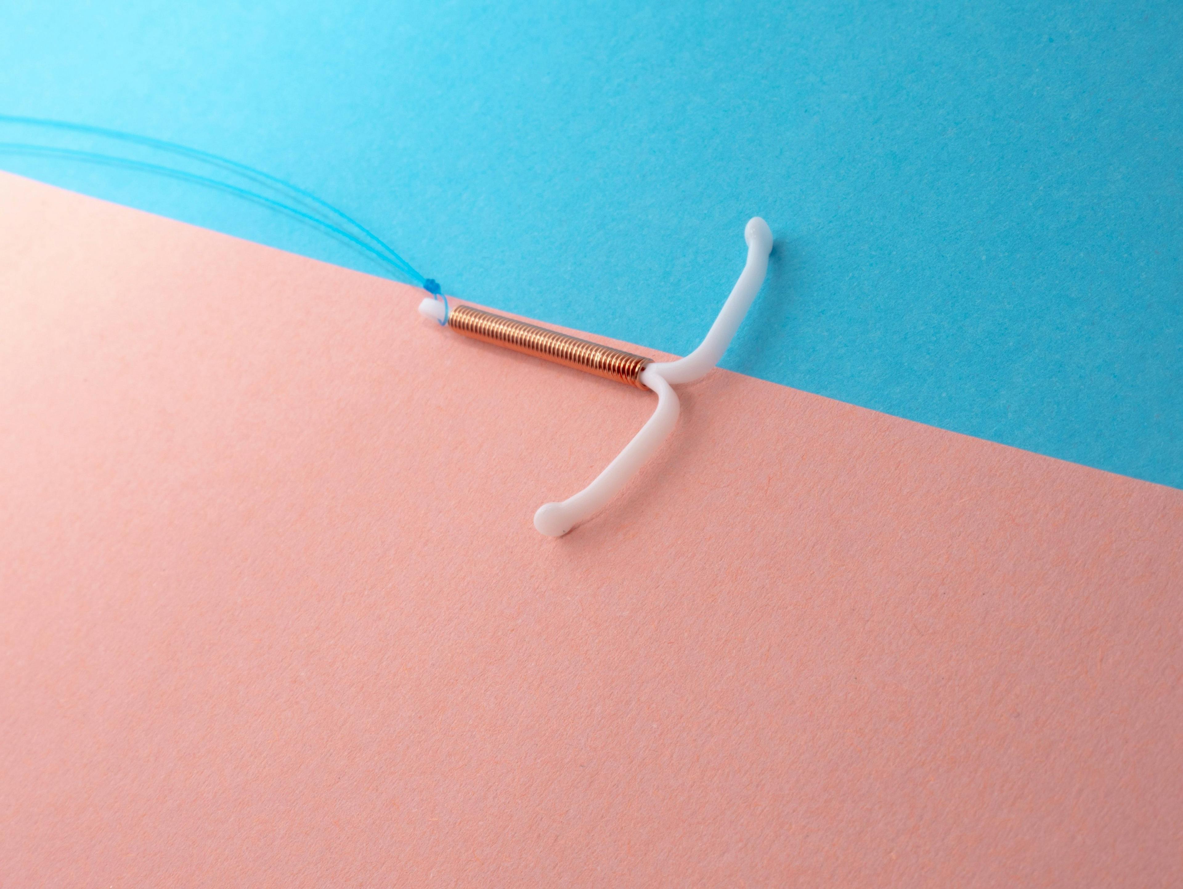 IUDs May Reduce Ovarian Cancer Risk by 30%
