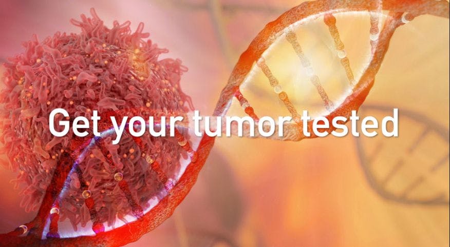 Got Colon Cancer? Get Your Tumor Tested