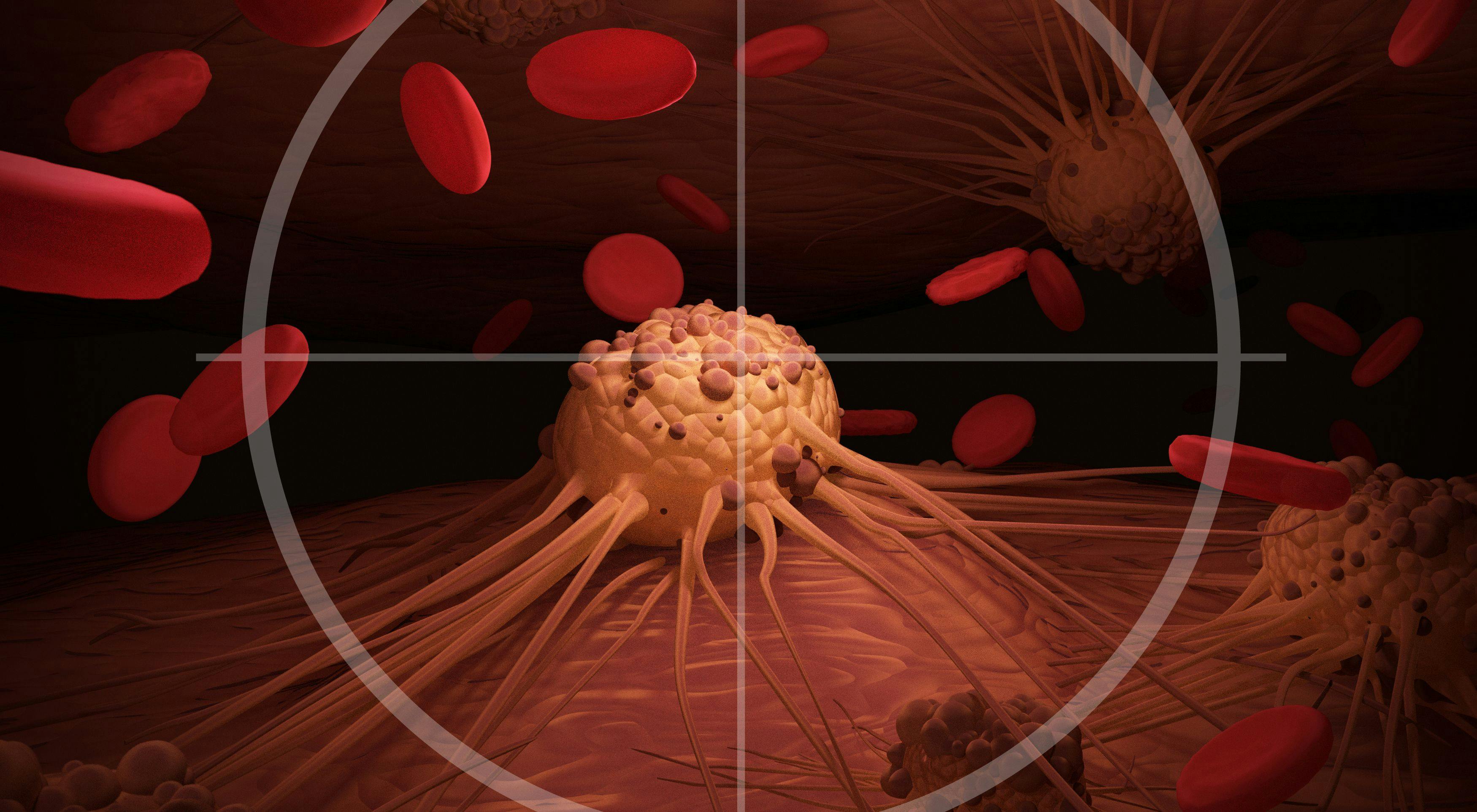 T cell with a target on a cancer cell — conceptual image of immune system fighting cancer