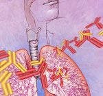  Xalkori Granted Breakthrough Designation for ROS1-Positive Lung Cancer