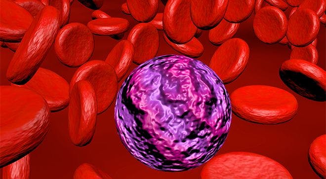 Novel Drug-Chemotherapy Combo After Stem Cell Transplant Associated With ‘Favorable Survival Outcomes’ in Group of Rare Blood Cancers