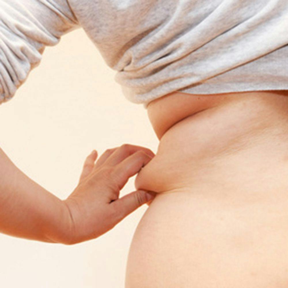 Increased Abdominal Fat Associated With Higher Cancer Risk