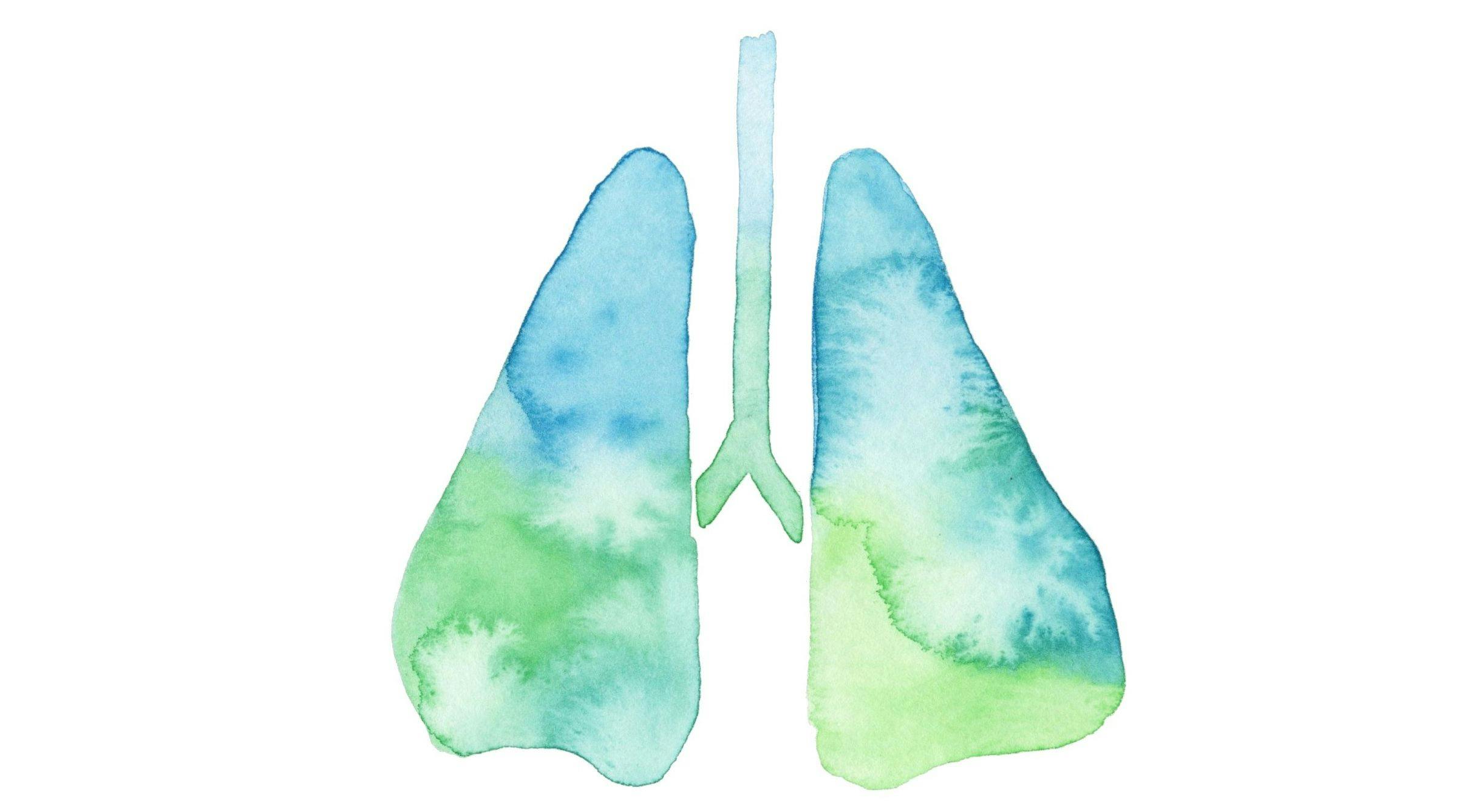 TKI Drug Plus Chemotherapy May Improve Lung Cancer Outcomes