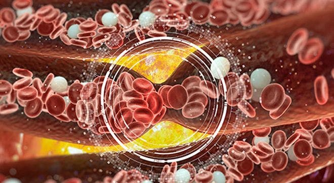 Oral Blood Thinner May Reduce Blood Clots in High-Risk Patients with Cancer