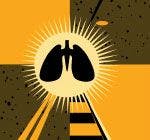 What’s Next in Lung Cancer Treatment