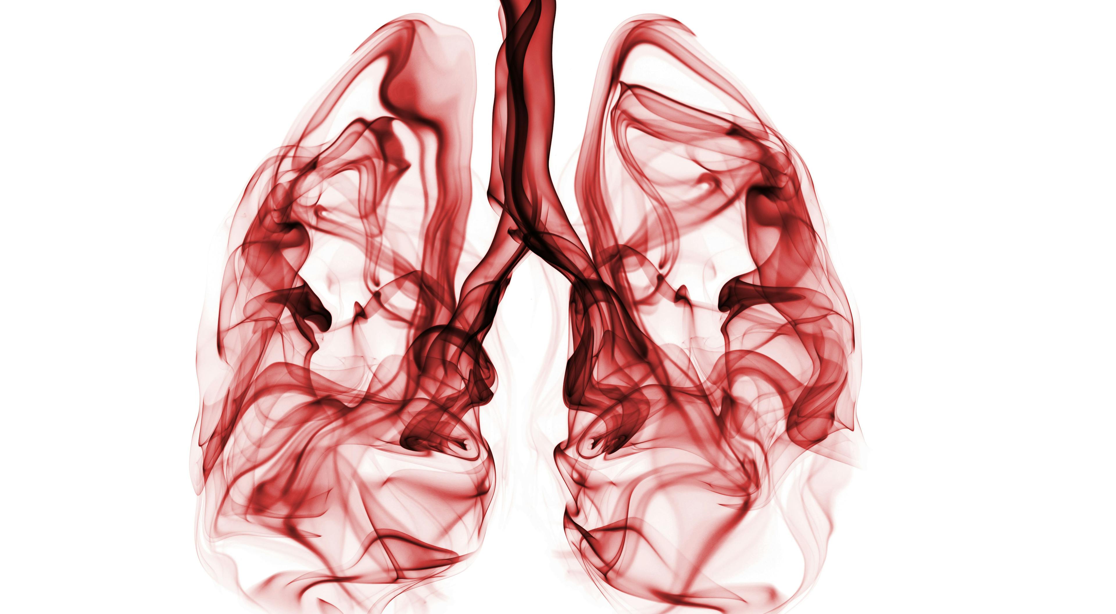 New Guidelines Aim to Improve Quality of Life For Patients With Advanced Lung Cancer