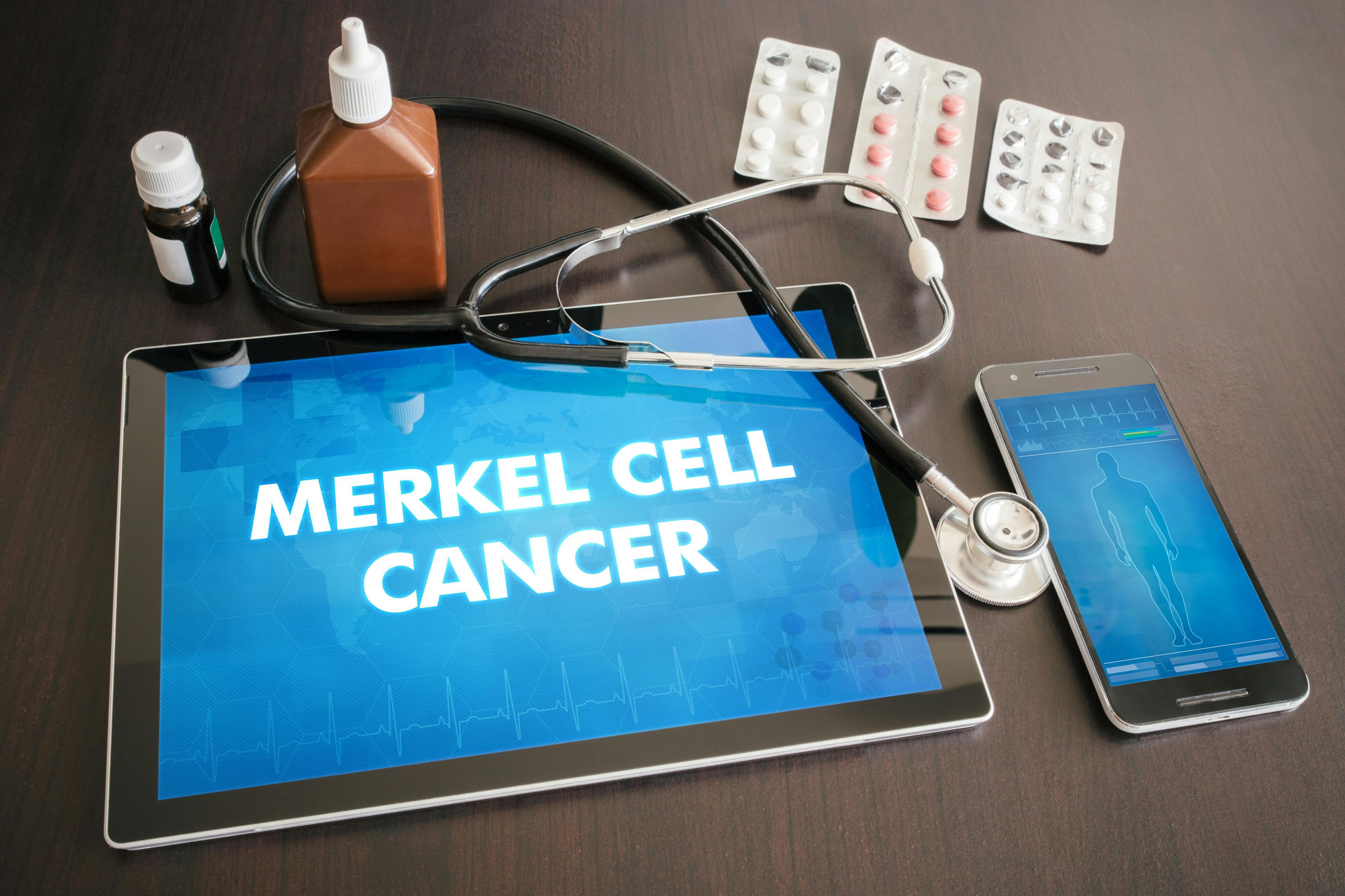 Merkel cell cancer (cancer type) diagnosis medical concept on tablet screen with stethoscope | Image credit: © ibreakstock - © stock.adobe.com
